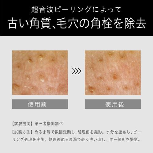 �Â��p���A�ь��̊p��������